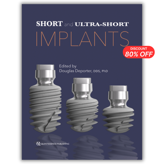 Short and Ultra-Short Implants