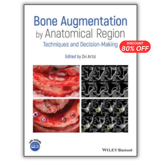 Bone Augmentation by Anatomical Region: Techniques and Decision-Making