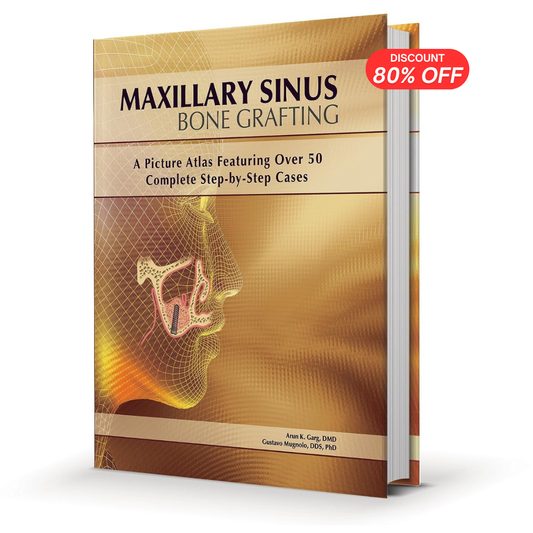 Maxillary Sinus Bone Grafting