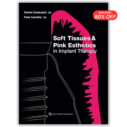 Soft Tissues and Pink Esthetics in Implant Therapy