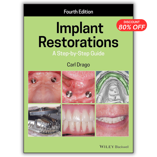 Implant Restorations: A Step-by-Step Guide, 4th Edition