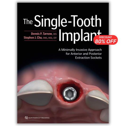The Single-Tooth Implant: A Minimally Invasive Approach for Anterior and Posterior Extraction Sockets