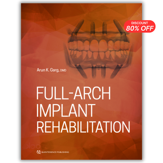 Full-Arch Implant Rehabilitation