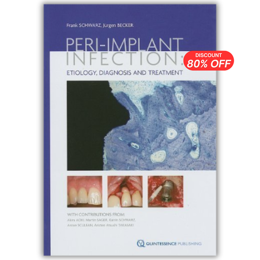 Peri-implant Infection: Etiology, Diagnosis and Treatment