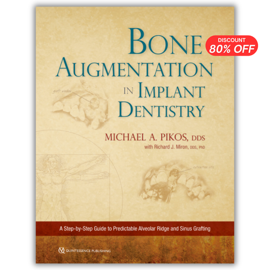 Bone Augmentation in Implant Dentistry
