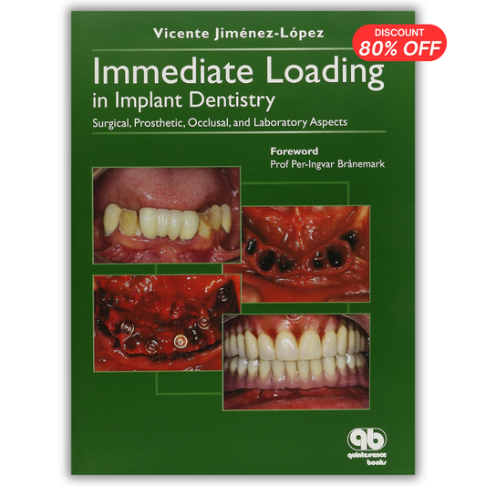 Immediate Loading in Implant Dentistry: Surgical, Prosthetic, Occlusal and Laboratory Aspects