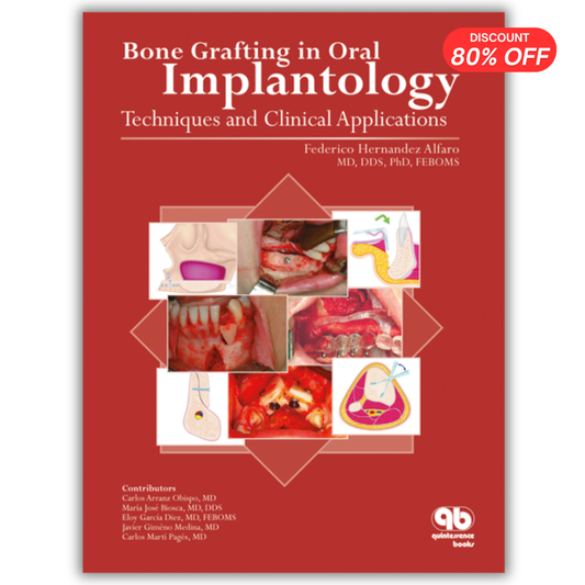 Bone Grafting in Oral Implantology: Techniques and Clinical Applications