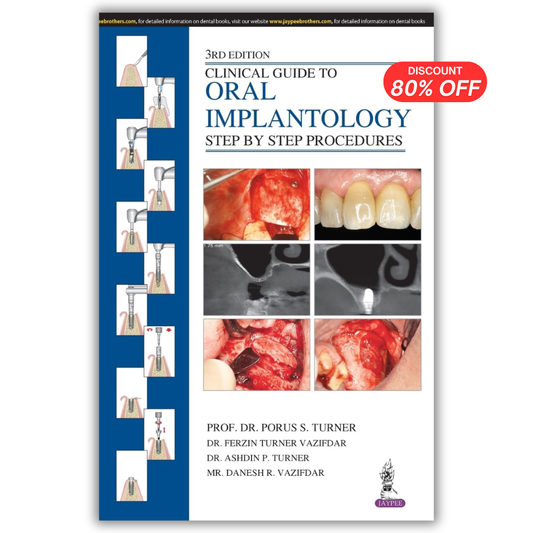 Clinical Guide to Oral Implantology: Step by Step Procedures, 3rd Edition