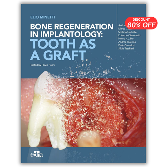 Bone Regeneration in Implantology: Tooth as a Graft