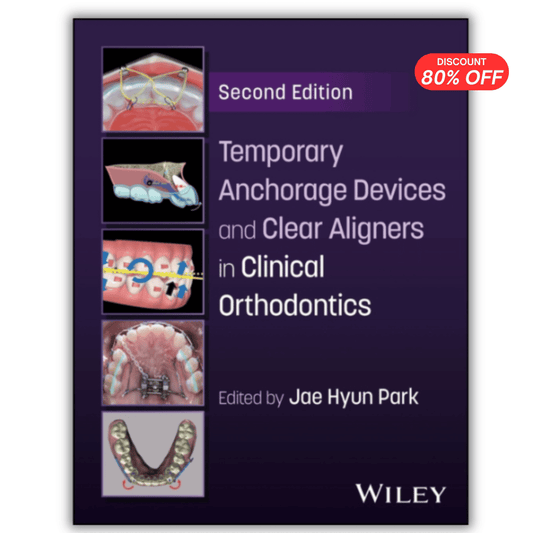 Temporary Anchorage Devices and Clear Aligners in Clinical Orthodontics PDF