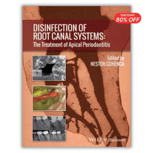 Disinfection of Root Canal Systems: The Treatment of Apical Periodontitis