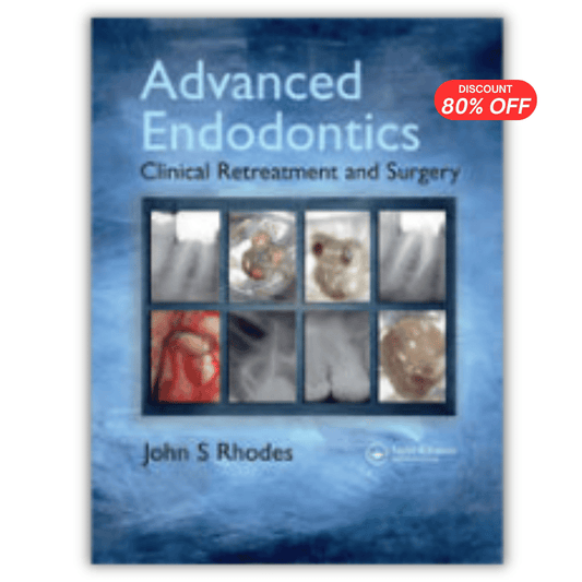 Advanced Endodontics: Clinical Retreatment and Surgery