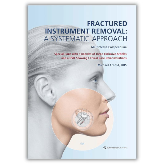 Fractured Instrument Removal: A Systematic Approach