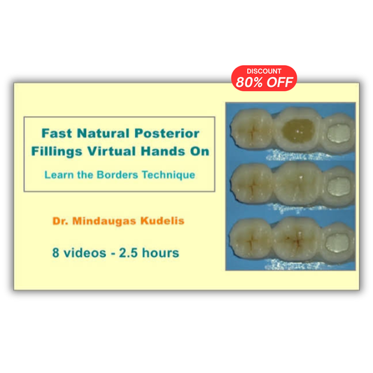 Fast Natural Posterior Fillings Virtual Hands On