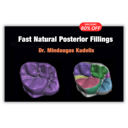 Fast Natural Posterior Fillings
