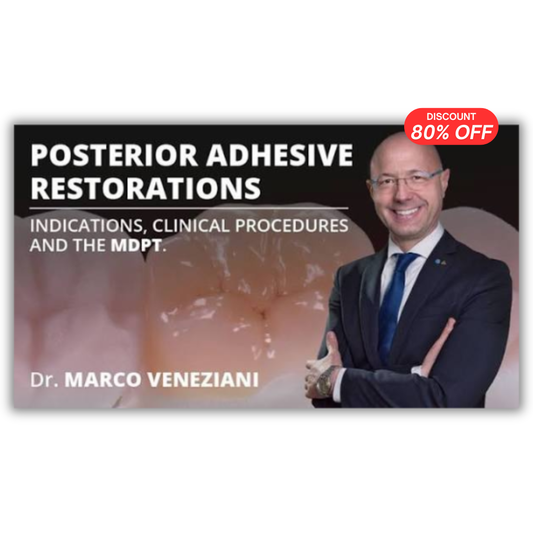 Posterior Adhesive Restorations: Indications, Clinical Procedures and mDPT Techniques