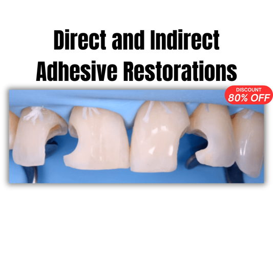 Direct and Indirect Adhesive Restorations