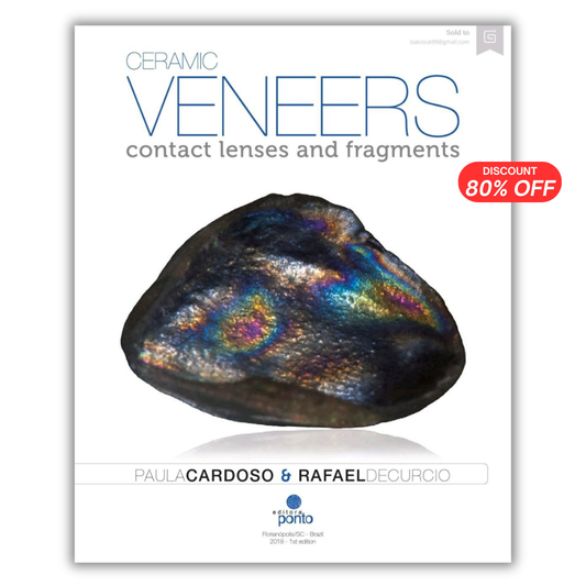 Ceramic Veneers: Contact Lenses and Fragments