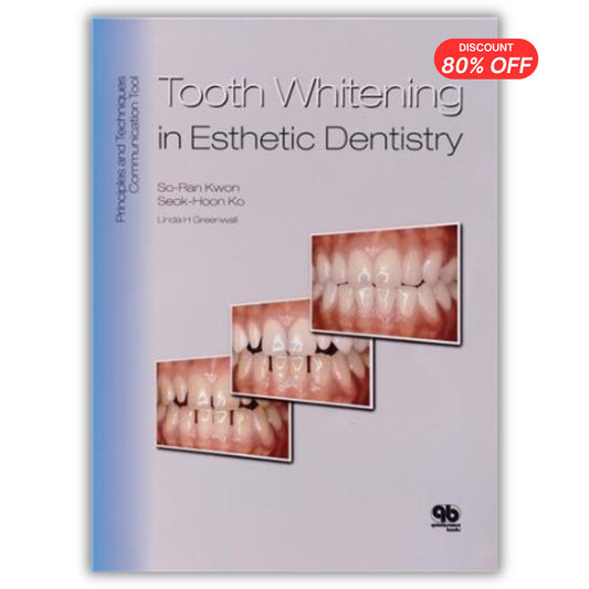 Tooth Whitening in Esthetic Dentistry: Principles and Techniques