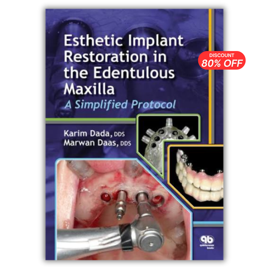 Esthetic Implant Restoration in the Edentulous Maxilla: A Simplified Protocol