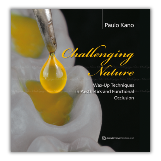 Challenging Nature: Wax-up Techniques in Aesthetics and Functional Occlusion (Scanned PDF)