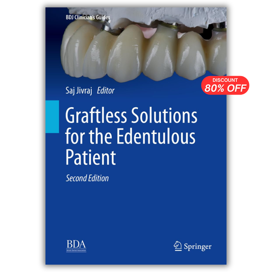 Graftless Solutions for the Edentulous Patient, 2nd Edition