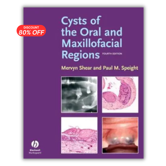 Cysts of the Oral and Maxillofacial Regions
