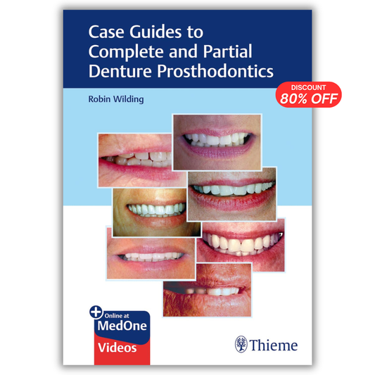 Case Guides to Complete and Partial Denture Prosthodontics