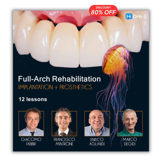 Full-Arch Rehabilitation: Implantation and Prosthetics