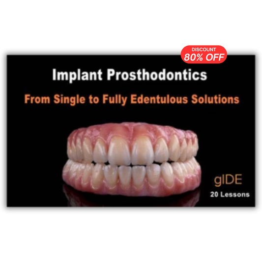 Implant Prosthodontics – From Single to Fully Edentulous Solutions