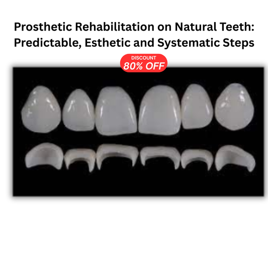 Prosthetic Rehabilitation on Natural Teeth: Predictable, Esthetic and Systematic Steps