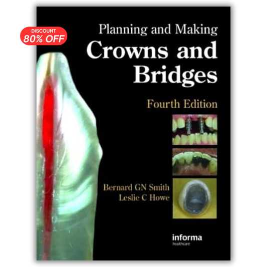 Planning and Making Crowns and Bridges, 4th Edition