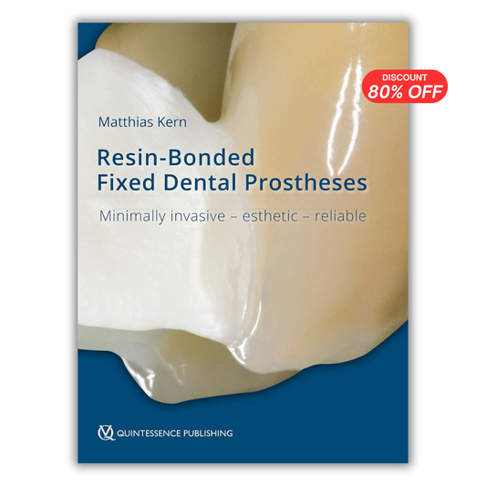 RBFDPs: Resin-Bonded Fixed Dental Prostheses