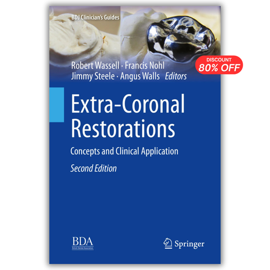 Extra-Coronal Restorations: Concepts and Clinical Application, 2nd Edition