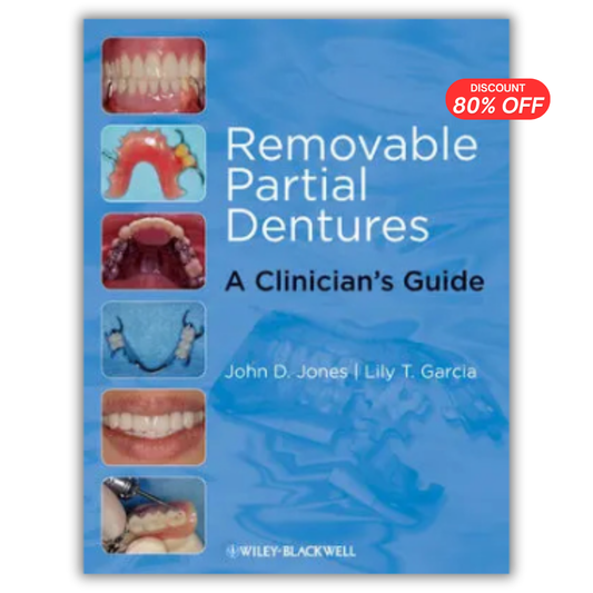 Removable Partial Dentures: A Clinician’s Guide