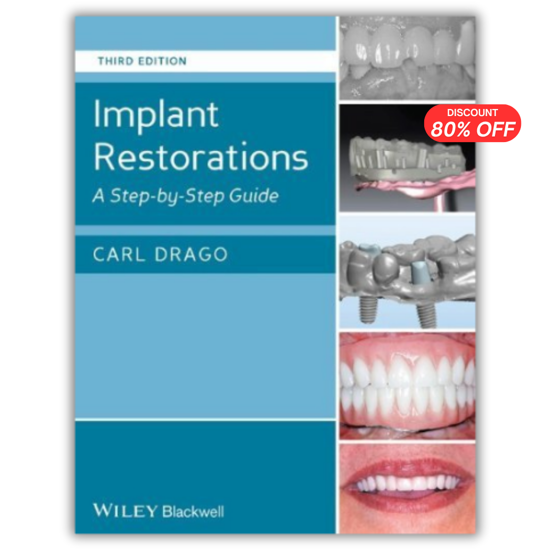 Implant Restorations: A Step-by-Step Guide 3rd Edition (PDF)