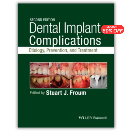 Dental Implant Complications: Etiology, Prevention, and Treatment, 2nd Edition