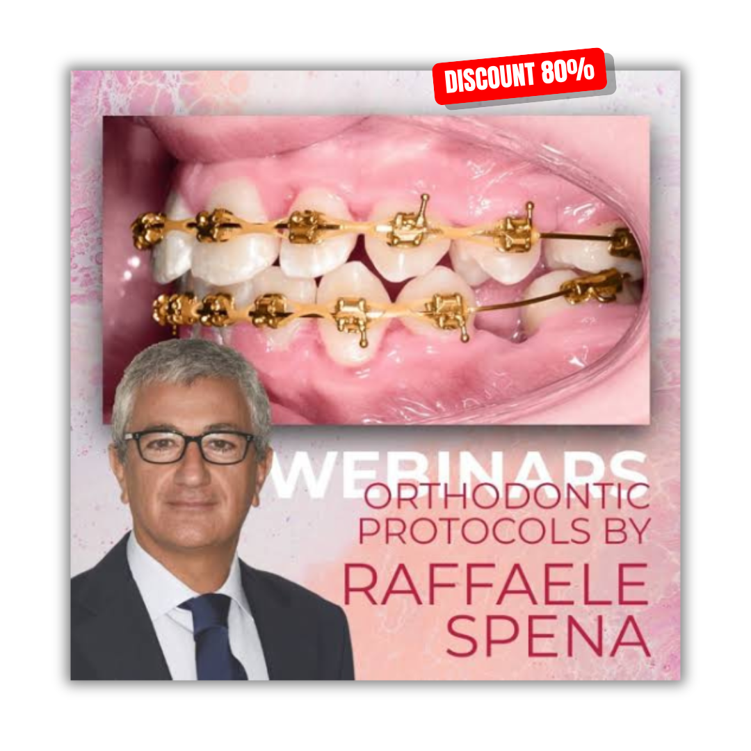 Orthodontic protocols by Raffaele Spena