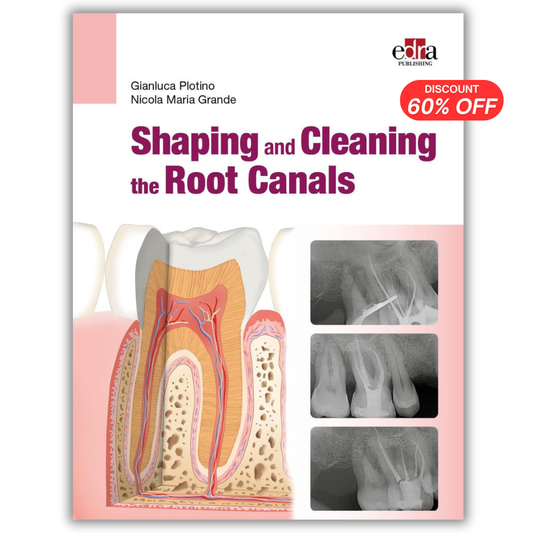 Shaping and Cleaning the Root  Canals.