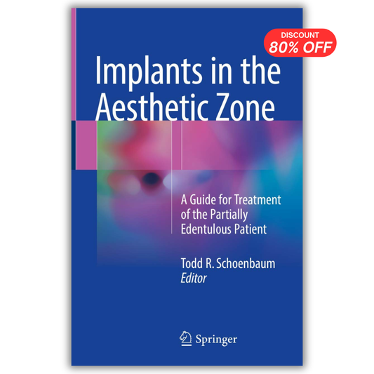 Implants in the Aesthetic Zone: A Guide for Treatment of the Partially Edentulous Patient