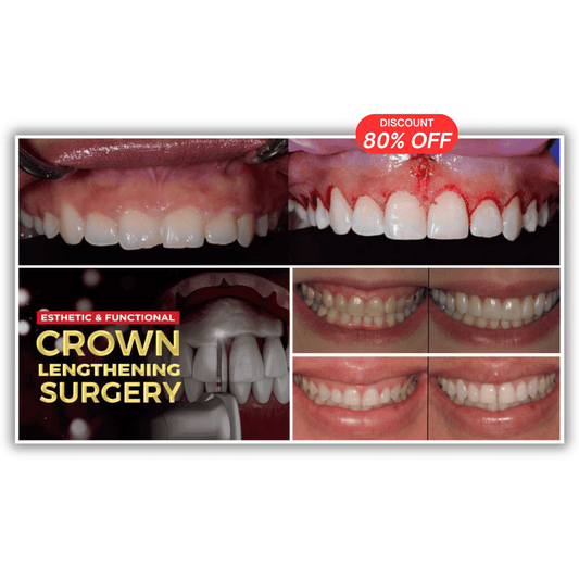 Esthetic and Functional Crown Lengthening Course