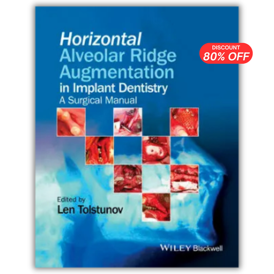 Horizontal Alveolar Ridge Augmentation in Implant Dentistry: A Surgical Manual