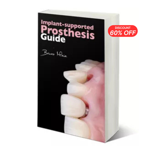 Implant Supported Prosthesis Guide