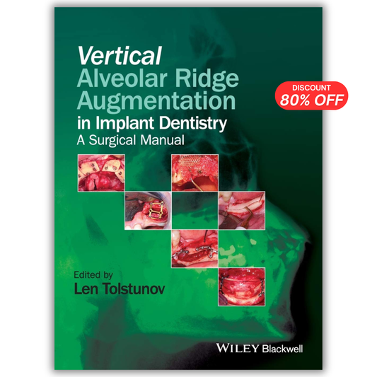 Vertical Alveolar Ridge Augmentation in Implant Dentistry: A Surgical Manual