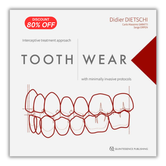 Tooth Wear: Interceptive Treatment Approach With Minimally Invasive Protocols (PDF)
