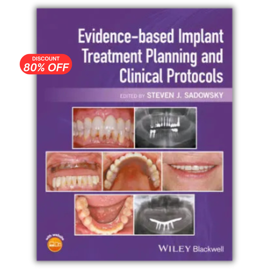 Evidence-based Implant Treatment Planning and Clinical Protocols