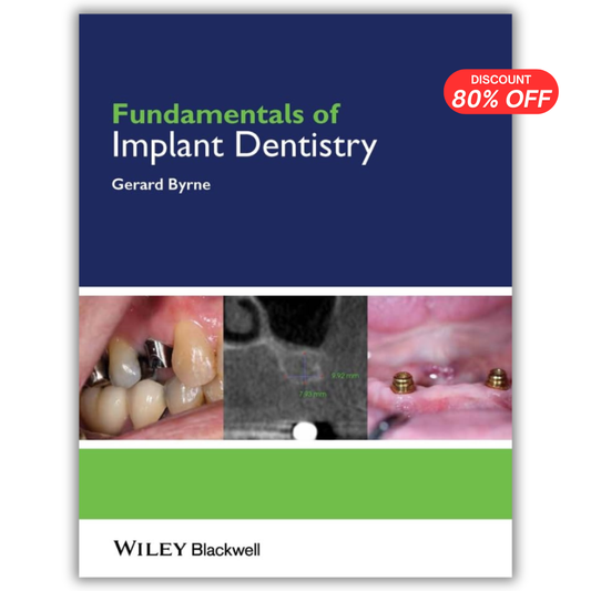 Fundamentals of Implant Dentistry