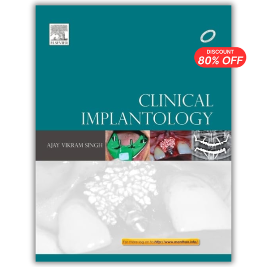 Clinical Implantology, 1st Edition