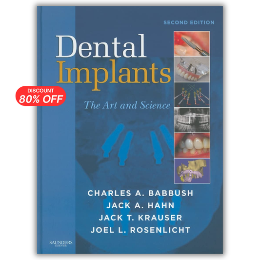 Dental Implants: the Art and Science, 2nd Edition
