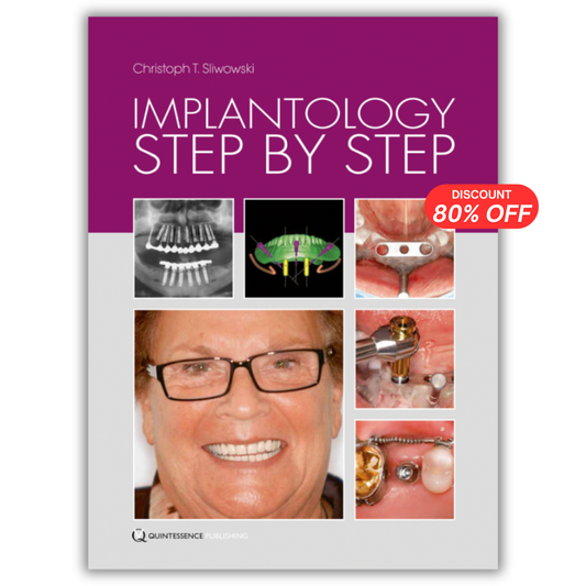 Implantology Step by Step, 2nd Edition